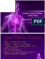 Basic Arrythmia Analysis