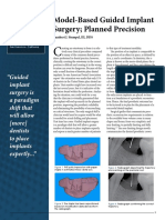 Model-Based Guided Implant Surgery Planned Precision