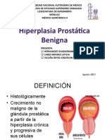 Hiperplasia Prostatic Benigna
