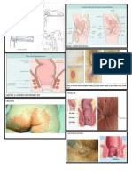 PX - Perimeum Rectal