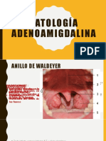 Patología Adenoamigdalina