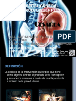 Cesárea y tipos de cesáreas indicaciones y contra indicaciones