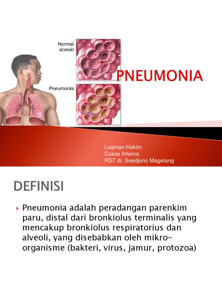 Panduan Lengkap Pneumonia | PDF | Kesehatan Holistik | Sains & Matematika