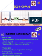 EKG Normal