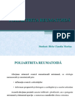 Poliartrita Reumatoida