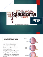 Glukoma (Prevention)