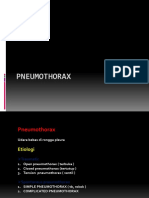 207589888-Pneumothorax-PPT.pptx