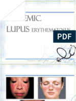 Systemic Lupus Erythematosus Sle