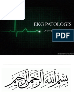 EKG PATOLOGIS.pptx