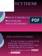 Polycythemi A: Polycythemia Vera Secondary Polychythemia