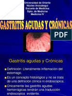 2) Gastritis Agudas y Cronicas