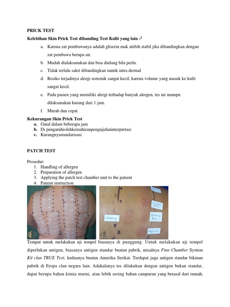 Prick Dan Patch Test PDF