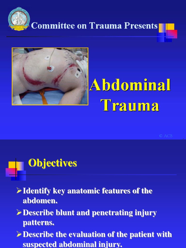 Abdominal Trauma | Major Trauma | Traumatology