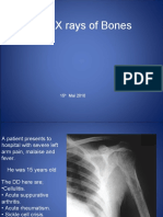 Plain X Rays of Bones