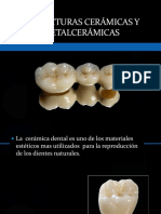 Ceramicas Dentales