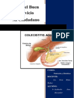 Dieta - Colecititis Aguda