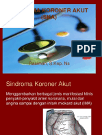 Sindroma Koroner Akut