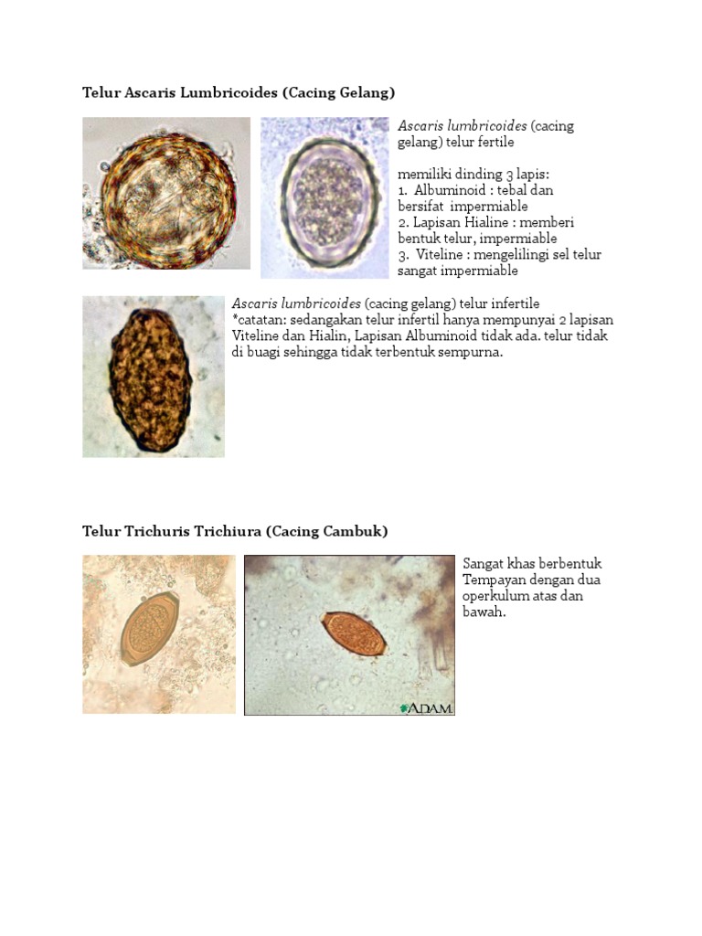 101 Gambar Telur  Cacing  Paragonimus Westermani HD 