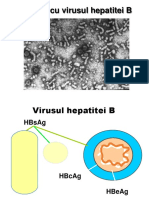 Hepatita B 