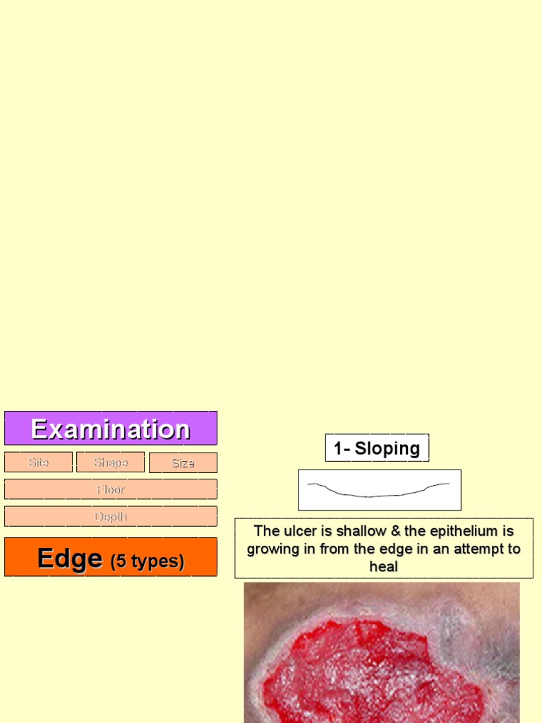 Types of Ulcer Edges Explained | PDF | Anatomy | Integumentary System