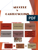 Onfalocele y Gastrosquisis