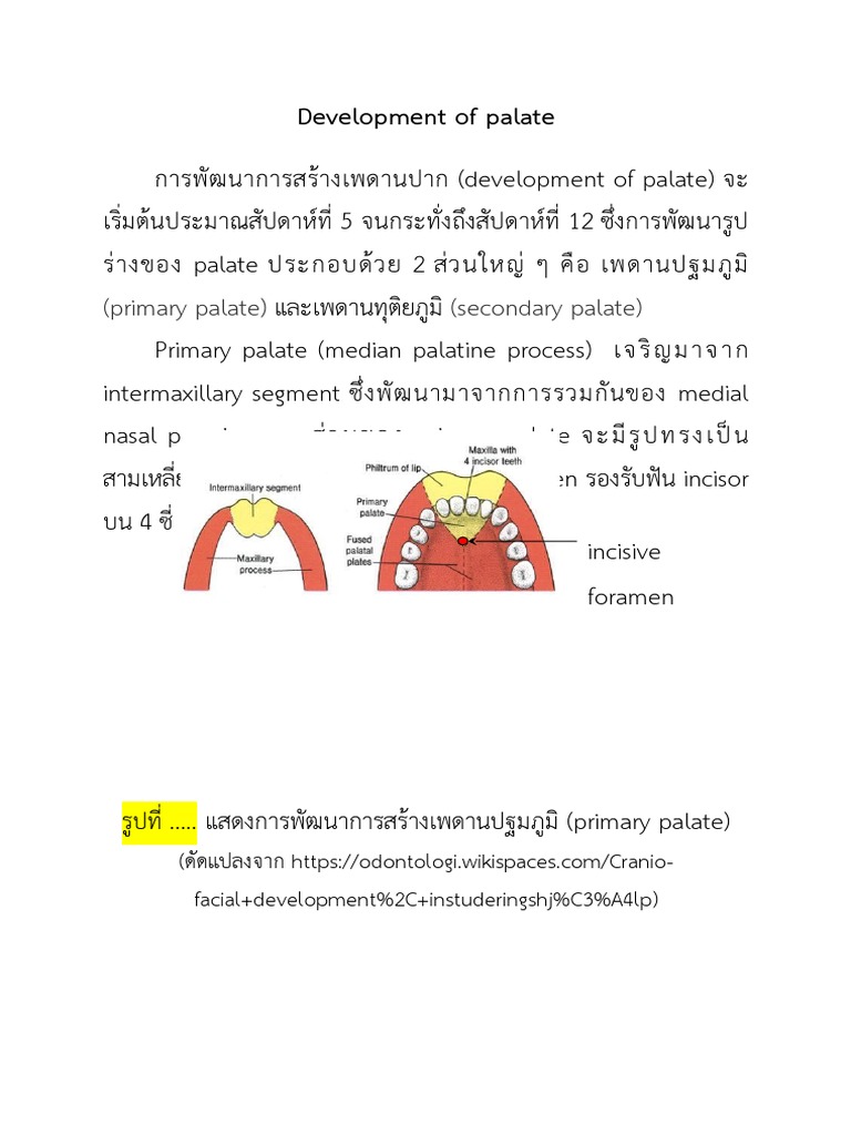 Development of Palatedevelopment of Palate | PDF