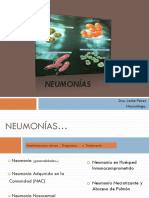 Neumonias.