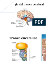 Sindromesdeltroncocerebral