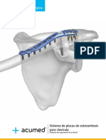 Sistema de Placas de Osteosintesis para Clavicula Acumed