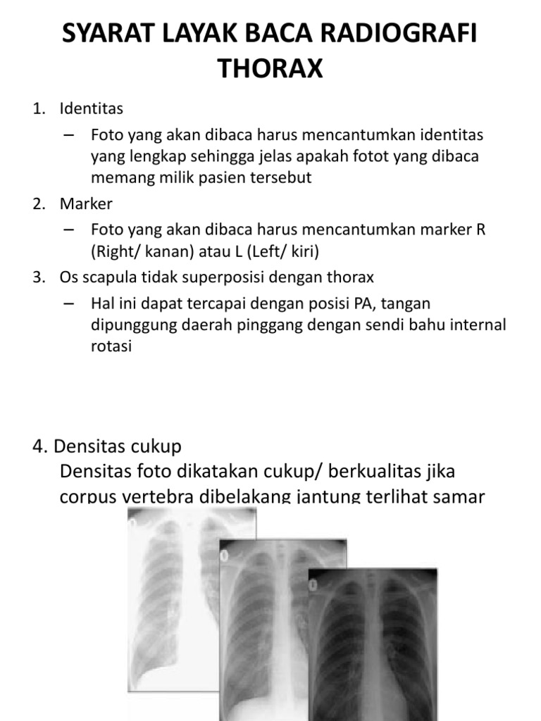Syarat Layak Baca Radiografi Thorax | PDF