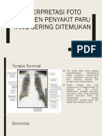 DETEKSI PENYAKIT PARU BERDASARKAN INTERPRETASI FOTO RONTGEN