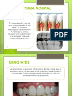 Anatomía normal y alteraciones óseas en periodontitis