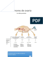 Tumores de Ovario