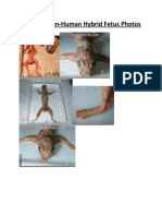 Aborted Alien-Human Hybrid Fetus Photos PDF
