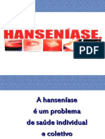 Hanseníase