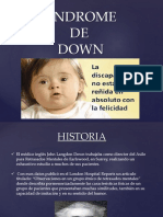 Sindrome de Down