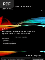Malformaciones de La Pared Abdominal