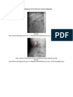 Gambaran Foto Polos Colelithiasis