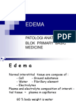 Edema