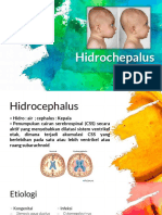 Hidrosefalus