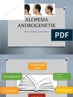 Alopesia Androgenetik