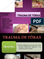 Trauma de Torax