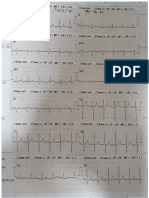INterpretasi EKG.docx