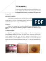 Papiloma Sel Skuamosa, Karsinoma Sel Skuamosa, Adenoma Thyroid, Fibroadenoma Mammae