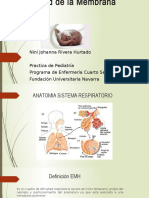 Enfermedad de la Membrana Hialina (1).pptx