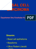 BASAL CELL CARCINOMA GUIDE