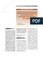 Metástasis Poco Habituales Del Carcinoma Diferenciado de Tiroides