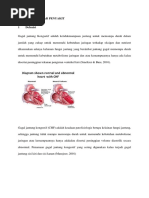 Download Lp Dan Askep Chf Nanda Nic Noc by djoyo supardjoe SN365229994 doc pdf