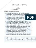 Right Bundle Branch Block