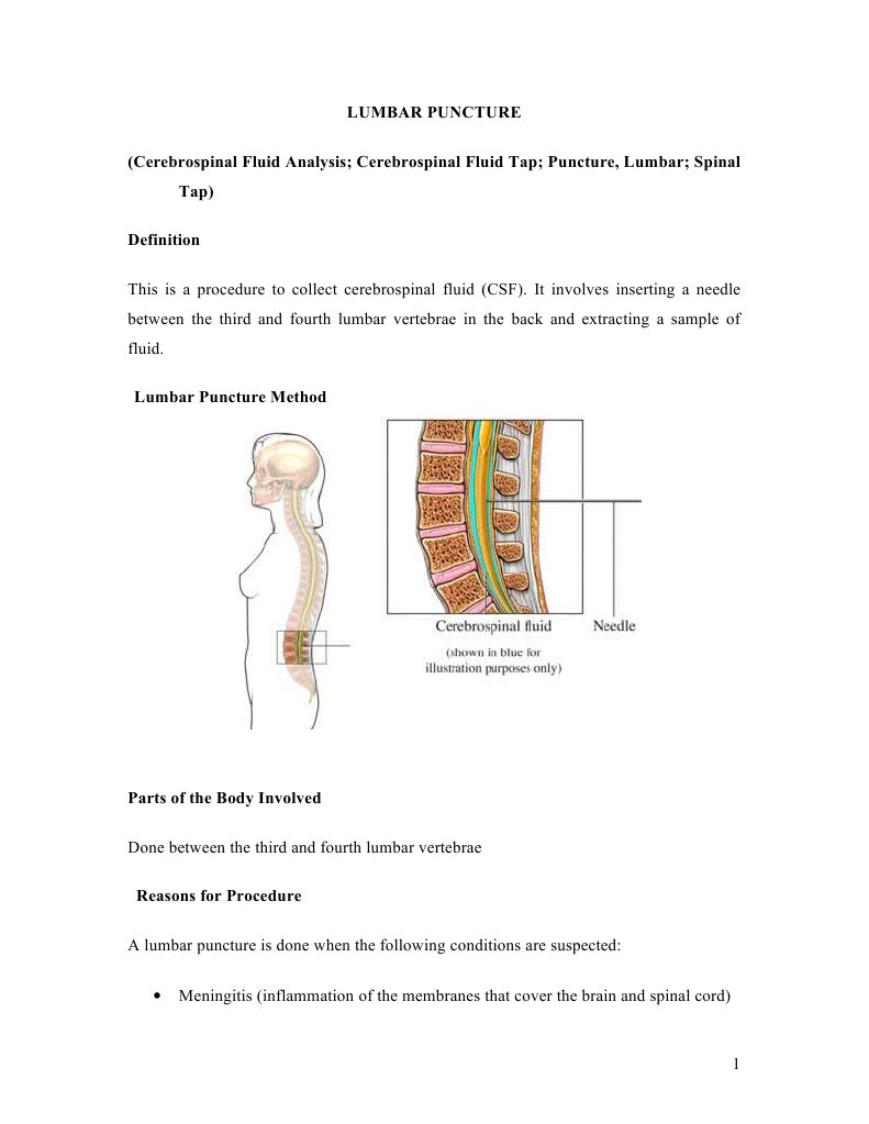 Lumbar Puncture (Cerebrospinal Fluid Analysis; Cerebrospinal Fluid Tap